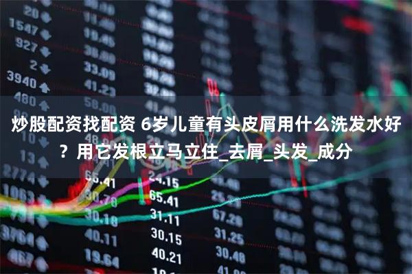 炒股配资找配资 6岁儿童有头皮屑用什么洗发水好？用它发根立马立住_去屑_头发_成分